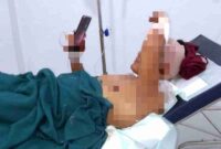 Sukamto, jurnalis asal Kecamatan Parengan, saat menjalani perawatan di rumah sakit di Kabupaten Tuban usai alami pembacokan, (Ist).